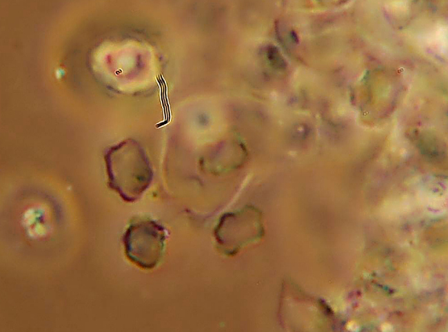 Poliporacea isolata. (Boletopsis leucomelaena)